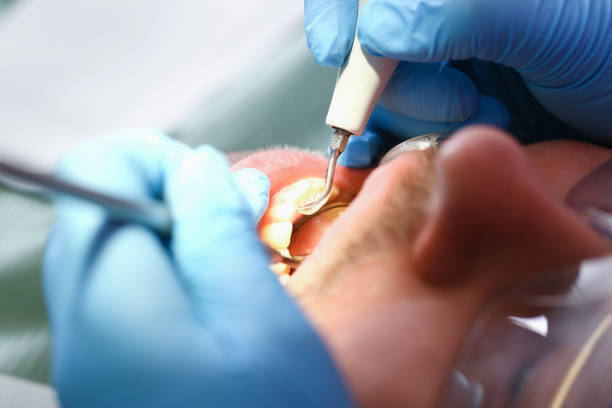 Best Pediatric Emergency Dentist in Lexington, OH