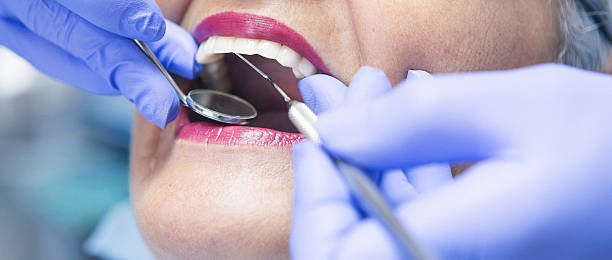 Best Same-Day Emergency Dental Services in Lexington, OH